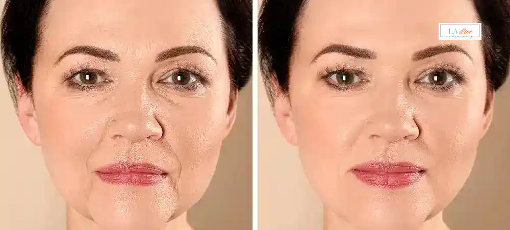 Why Aren’t My Skincare Products Making My Sagging Skin Look Firmer Sleaford?